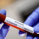 (Հայերեն) Ինչպես պաշտպանվել կորոնավիրուսից